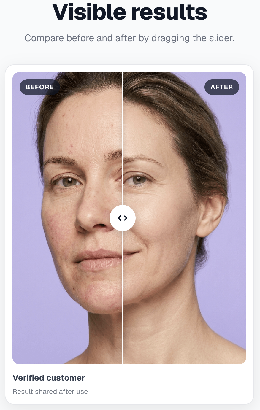 Preview — Before / After slider
