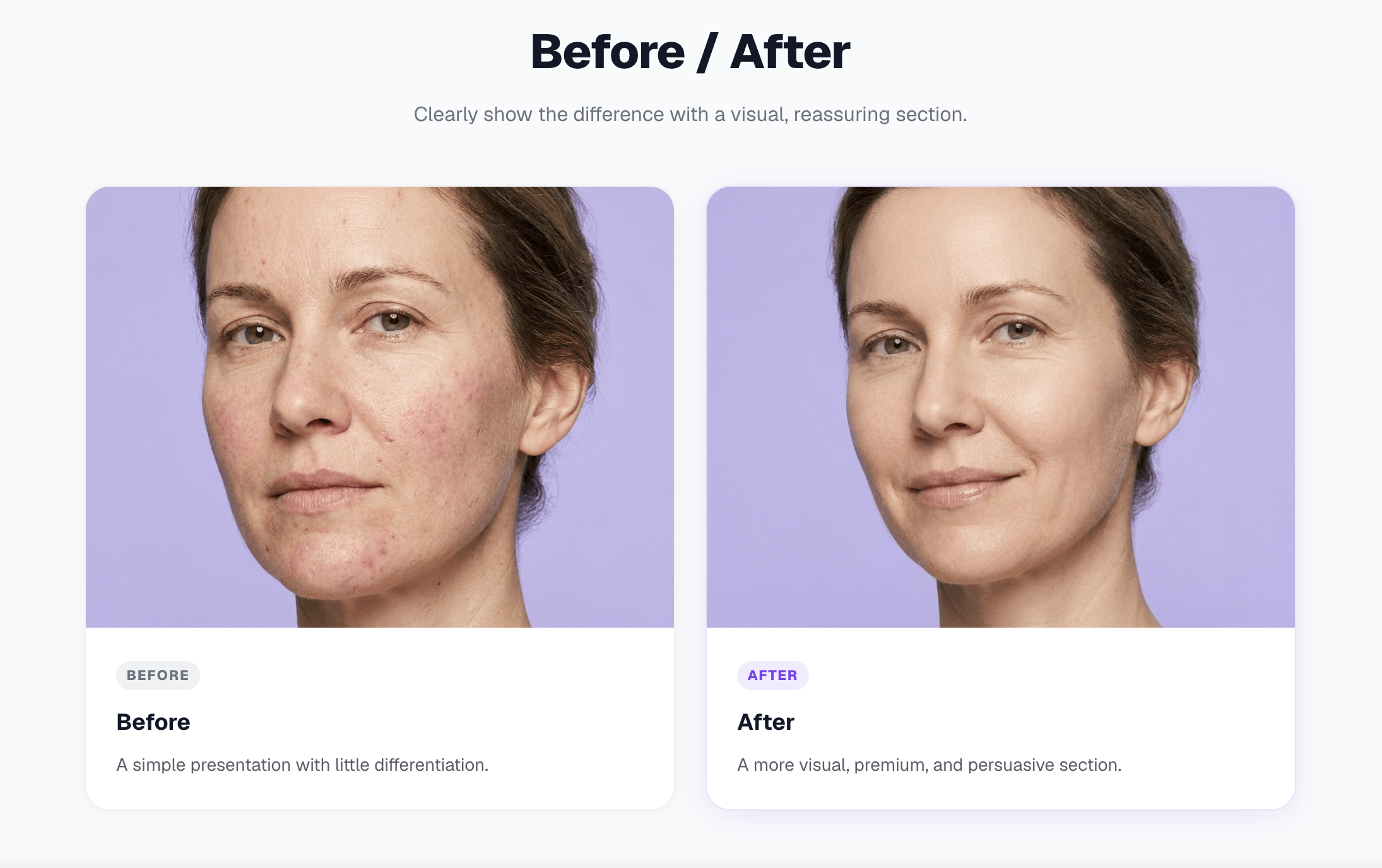 Preview — Before / After